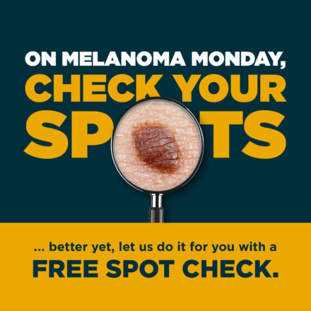 Monument Health dermatologists offer free skin cancer screenings for Melanoma Monday