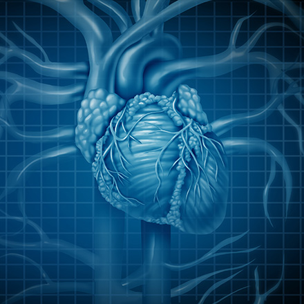 New Clinical Trial: JetStream, a Novel Device for Removing Lower Extremity Blockages
